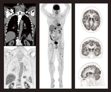 がん組織を画像化するのに特化したPET検査+臓器を鮮明に画像かできるCT